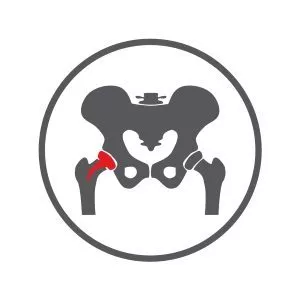 Icon_BG_Implantate